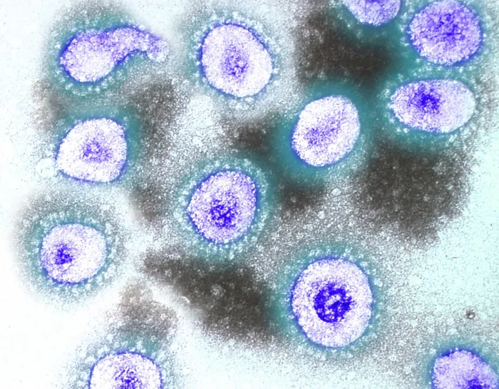 Framed Print : TEM of Coronavirus OC43