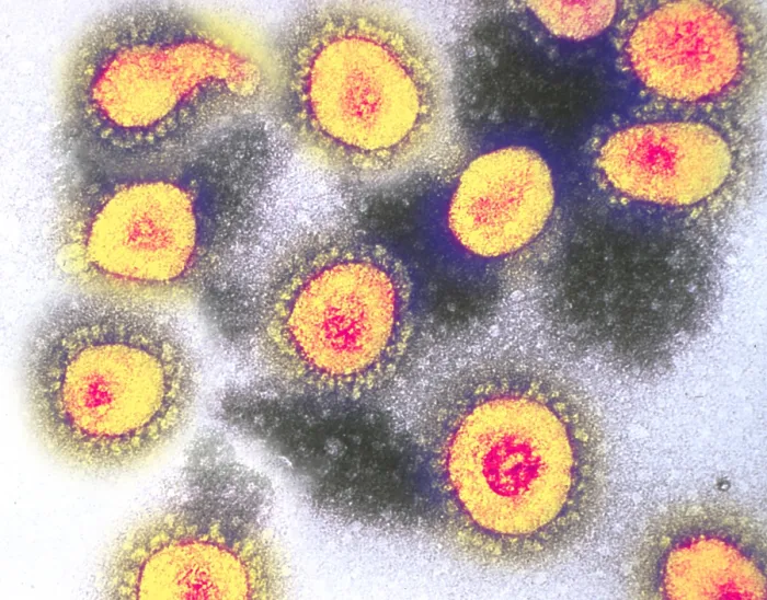 Framed Print : TEM of Coronavirus OC43 Framed Print : TEM of Coronavirus OC43