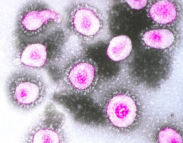 Framed Print : TEM of Coronavirus OC43
