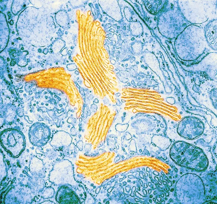Framed Print : TEM of Golgi Bodies