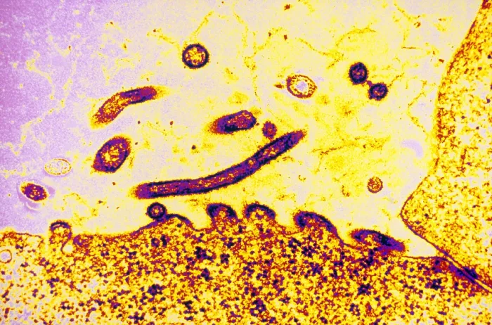 Framed Print : TEM of Respiratory Syncytial Virus Framed Print : TEM of Respiratory Syncytial Virus