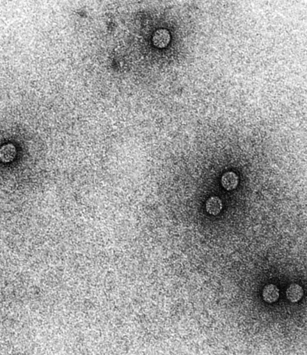 Framed Print : TEM of Rhinoviruses Framed Print : TEM of Rhinoviruses