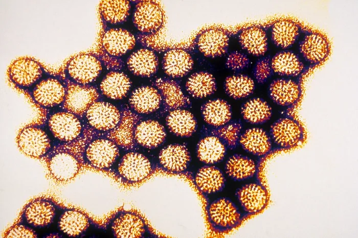 Framed Print : TEM of Rotavirus