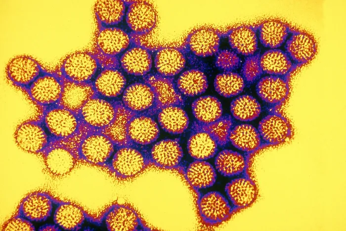 Framed Print : TEM of Rotavirus Framed Print : TEM of Rotavirus