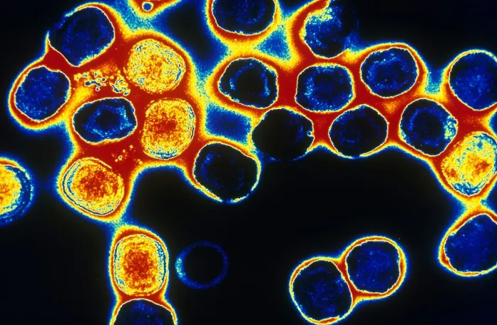 Framed Print : TEM of Vaccinia Virus Framed Print : TEM of Vaccinia Virus