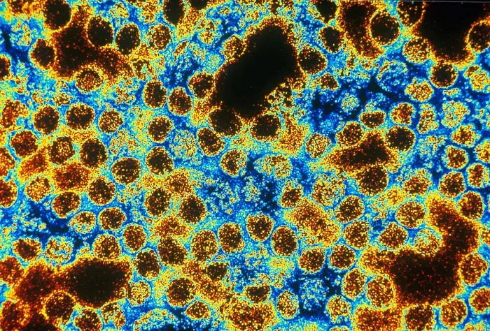 Framed Print : TEM of Yellow Fever Framed Print : TEM of Yellow Fever