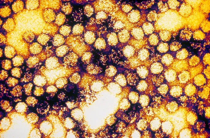 Framed Print : TEM of Yellow Fever