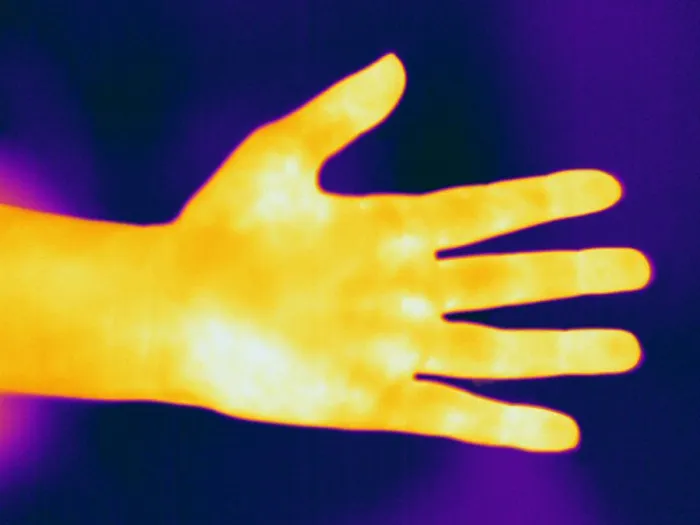 Framed Print : Thermogram of a Hand