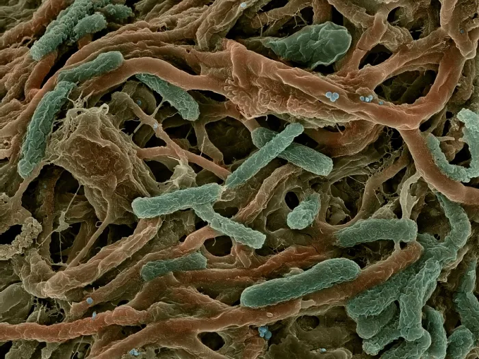 Framed Print : Thermophile Bacteria Framed Print : Thermophile Bacteria