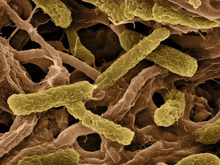 Framed Print : Thermophile Bacteria