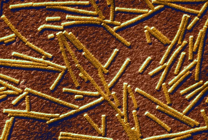 Framed Print : Tobacco mosaic Virus, TEM Framed Print : Tobacco mosaic Virus, TEM
