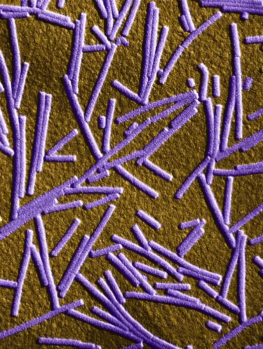 Framed Print : Tobacco mosaic Virus, TEM