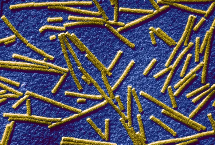 Framed Print : Tobacco mosaic Virus, TEM