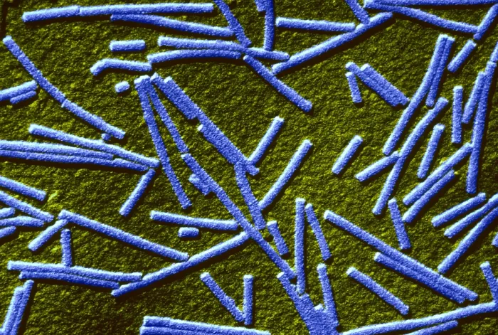 Framed Print : Tobacco mosaic Virus, TEM