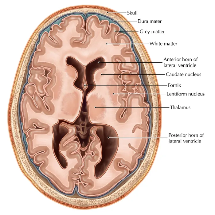 Framed Print : Transverse Section of the Brain Framed Print : Transverse Section of the Brain