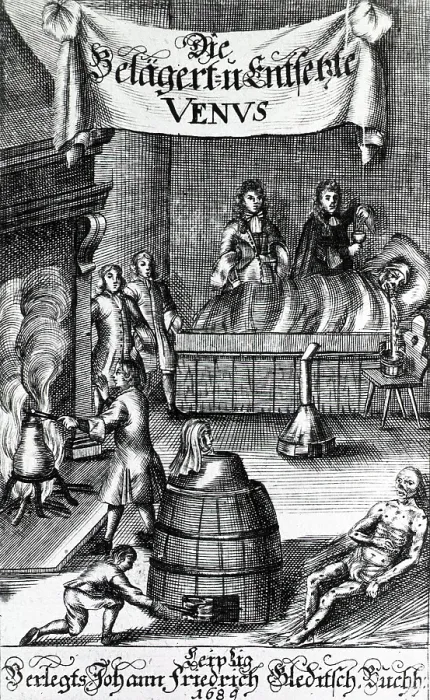 Framed Print : Treatments for Syphilis, 17th century Framed Print : Treatments for Syphilis, 17th century