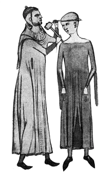 Framed Print : Trepanning, 14th Century Framed Print : Trepanning, 14th Century