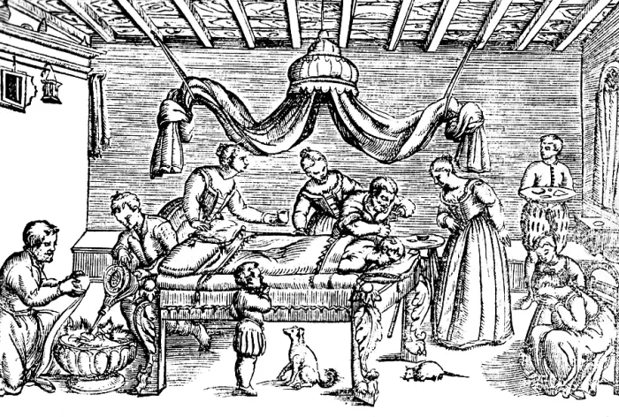 Framed Print : Trepanning, 1573 Framed Print : Trepanning, 1573
