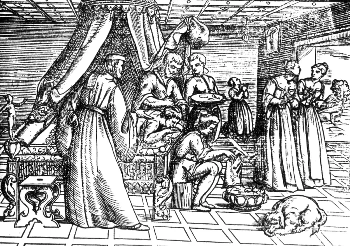 Framed Print : Trepanning, 1573 Framed Print : Trepanning, 1573