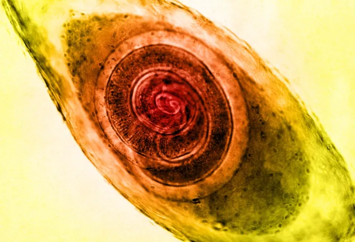 Framed Print : Trichinella in Muscle, light micrograph Framed Print : Trichinella in Muscle, light micrograph
