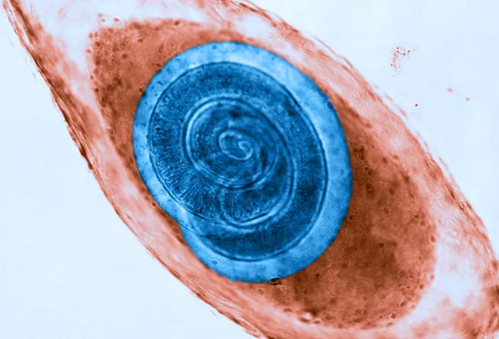 Framed Print : Trichinella in Muscle (LM) under a microscope