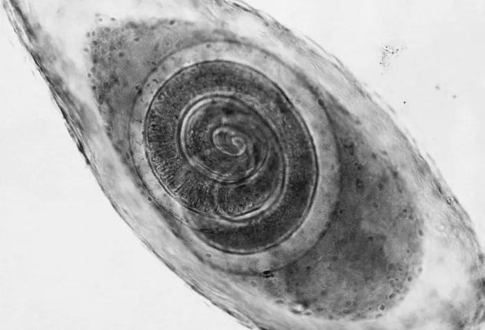 Framed Print : Trichinella in Muscle (LM) under a microscope