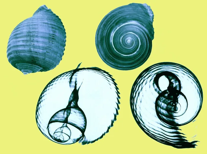Framed Print : Tun shell, X-ray Framed Print : Tun shell, X-ray