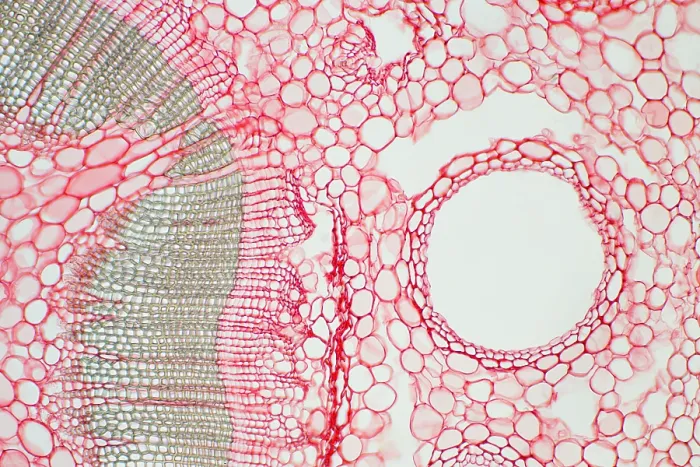 Framed Print : Umbrella Pine Stem under a microscope Framed Print : Umbrella Pine Stem under a microscope