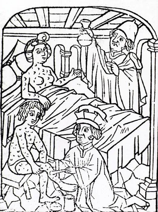 Framed Print : Uroscopy, Patients with Syphilis, 1497 Framed Print : Uroscopy, Patients with Syphilis, 1497