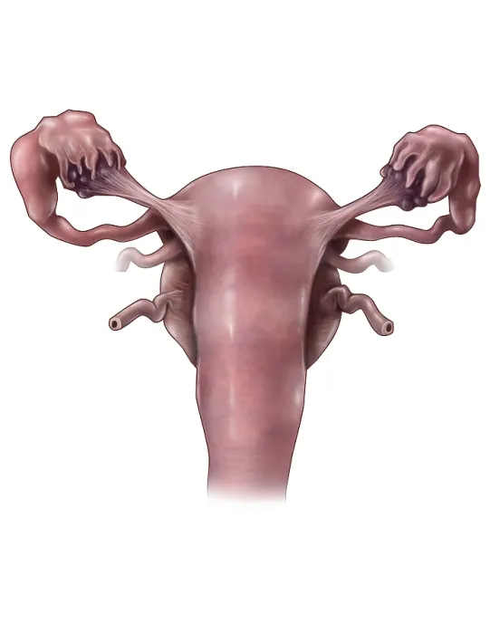 Framed Print : Uterus, Ovaries and Bladder (Posterior View) Framed Print : Uterus, Ovaries and Bladder (Posterior View)