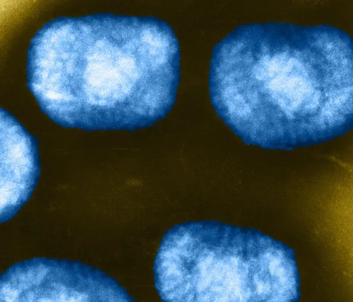 Framed Print : Vaccinia Virus, Eradicated Smallpox, TEM