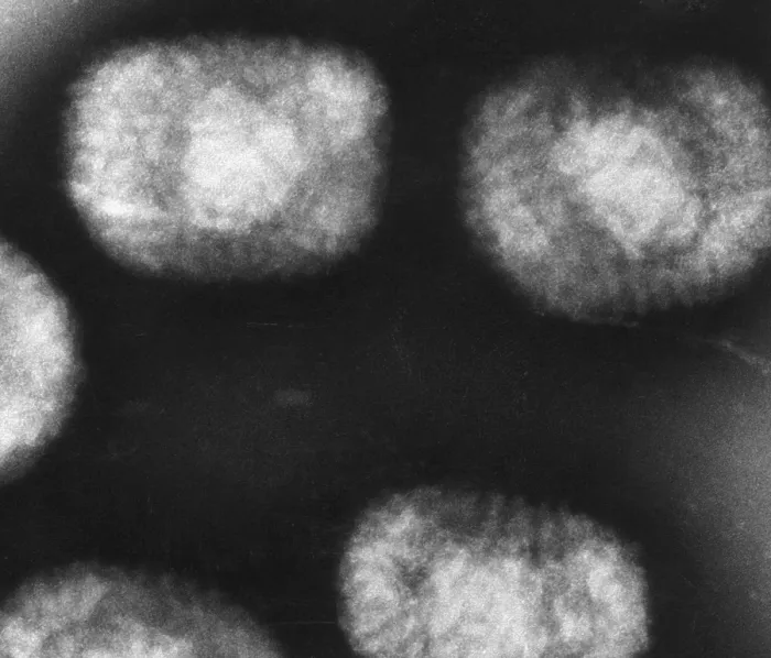 Framed Print : Vaccinia Virus, Eradicated Smallpox, TEM