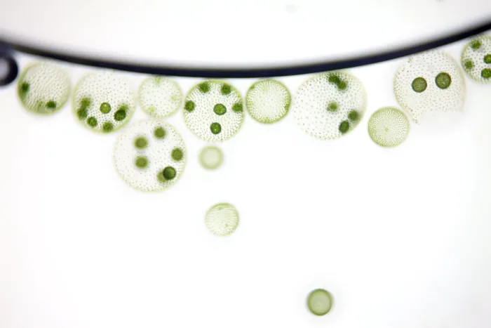 Framed Print : Volvox Algae Framed Print : Volvox Algae