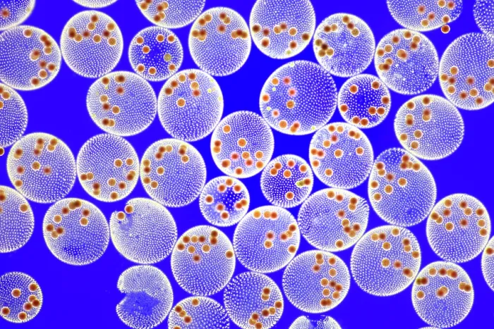 Framed Print : Volvox tertius, Zygospores Framed Print : Volvox tertius, Zygospores