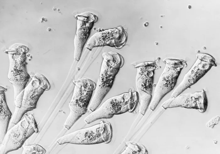 Framed Print : Vorticella (LM) under a microscope Framed Print : Vorticella (LM) under a microscope