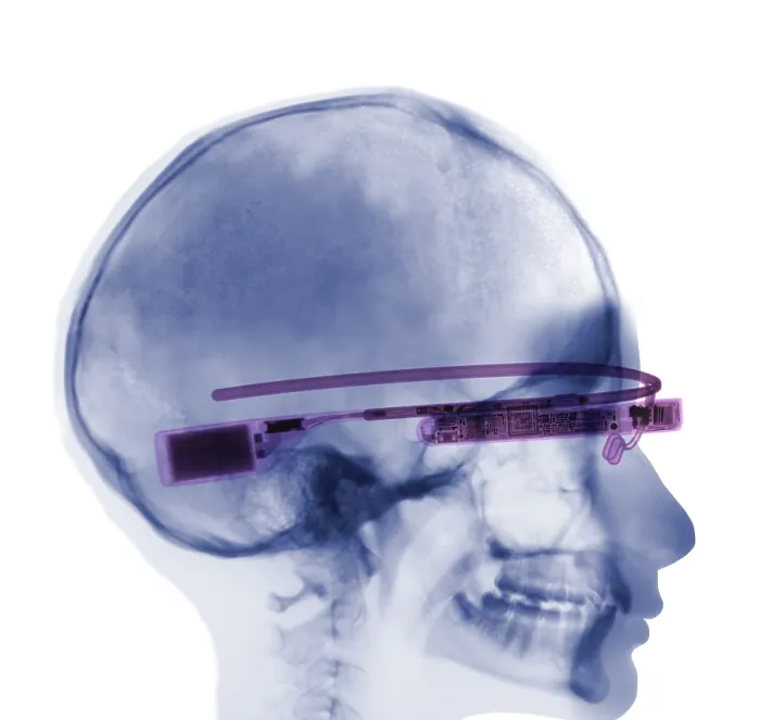 Framed Print : Woman Wearing Google Glass, X-ray Framed Print : Woman Wearing Google Glass, X-ray
