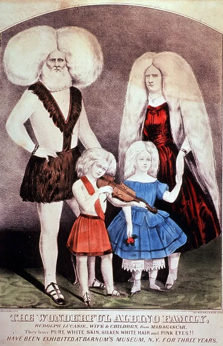 Framed Print : The Wonderful Lucasie Albino Family, 1857 Framed Print : The Wonderful Lucasie Albino Family, 1857