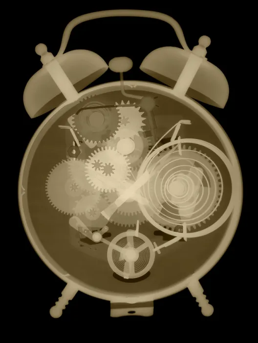 Framed Print : X-ray of an Alarm Clock Framed Print : X-ray of an Alarm Clock