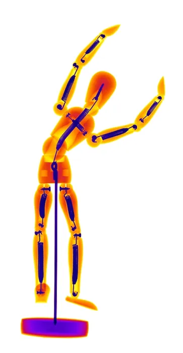 Framed Print : An X-ray of an artist's figure model