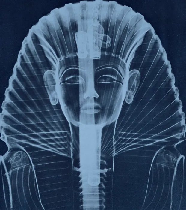 Framed Print : X-ray of the Egyptian Mask of Tut