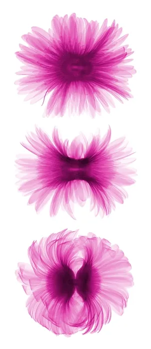 Framed Print : X-ray Gerber Daisies Framed Print : X-ray Gerber Daisies