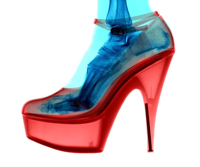 Framed Print : An X-ray of a High Heel Shoe