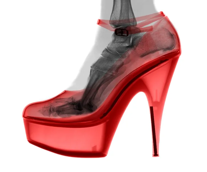 Framed Print : An X-ray of a High Heel Shoe Framed Print : An X-ray of a High Heel Shoe