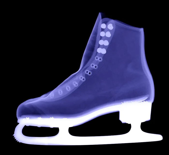 Framed Print : X-ray of an Ice Skate Framed Print : X-ray of an Ice Skate