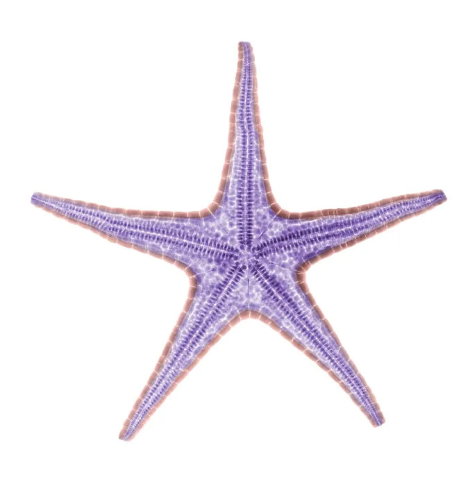 Framed Print : X-ray of Starfish