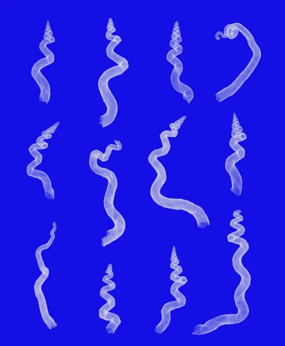 Framed Print : X-ray of worm shells