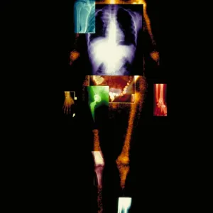 Composite of body