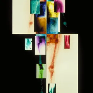 Composite of body