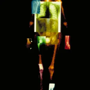 Composite of body