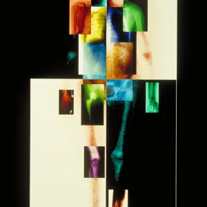 Composite of body